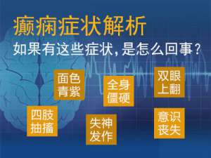 肌阵挛癫痫：成都看癫痫病的医院?癫疯病怎么治疗好